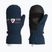 Детски скиорски ръкавици Rossignol Jr Roc Impr M dark navy