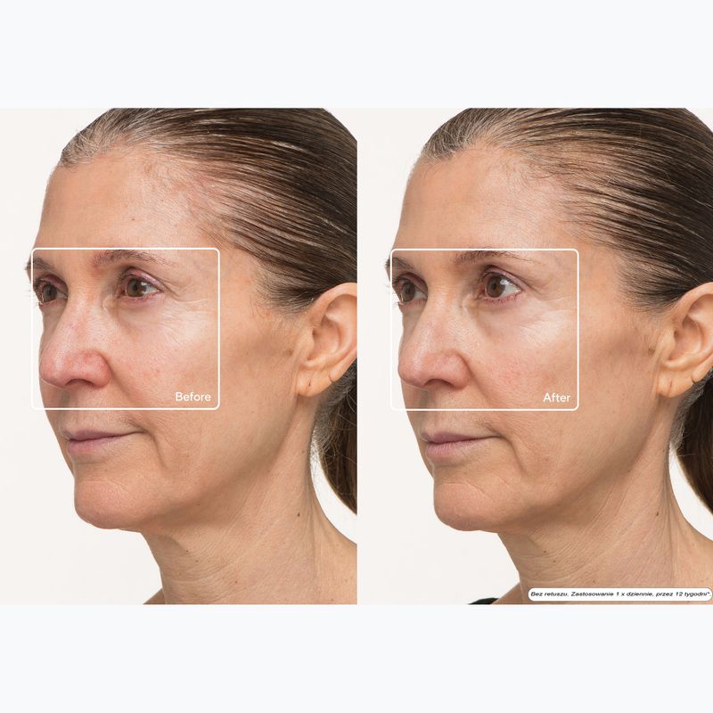 Маска LED за лице Therabody TheraFace LED Mask 10