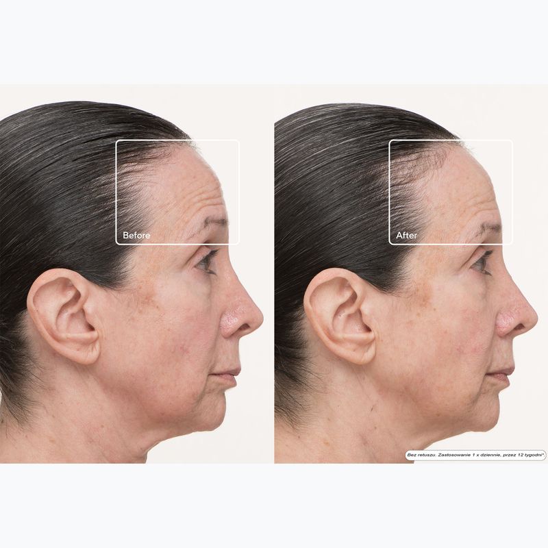 Маска LED за лице Therabody TheraFace LED Mask 11