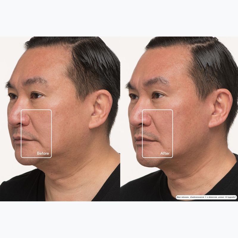 Маска LED за лице Therabody TheraFace LED Mask 12