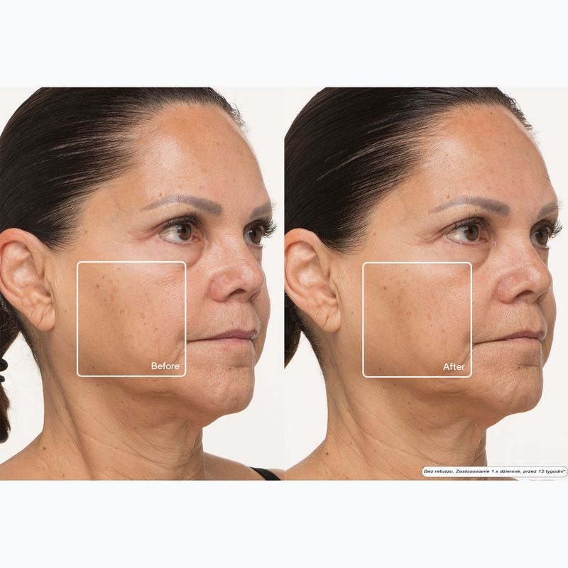 Маска LED за лице Therabody TheraFace LED Mask 13